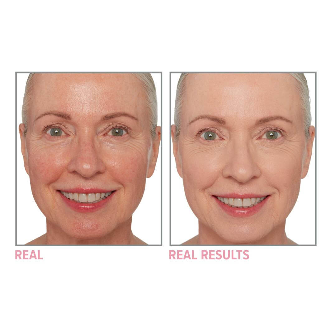 Your Skin But Better Foundation + Skincare