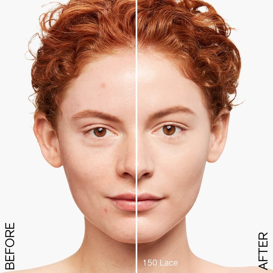 Radiant Lift Foundation
