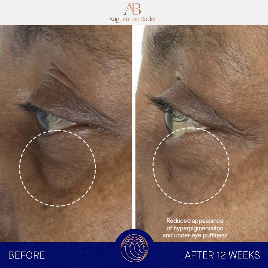 The Eye Cream Nomad