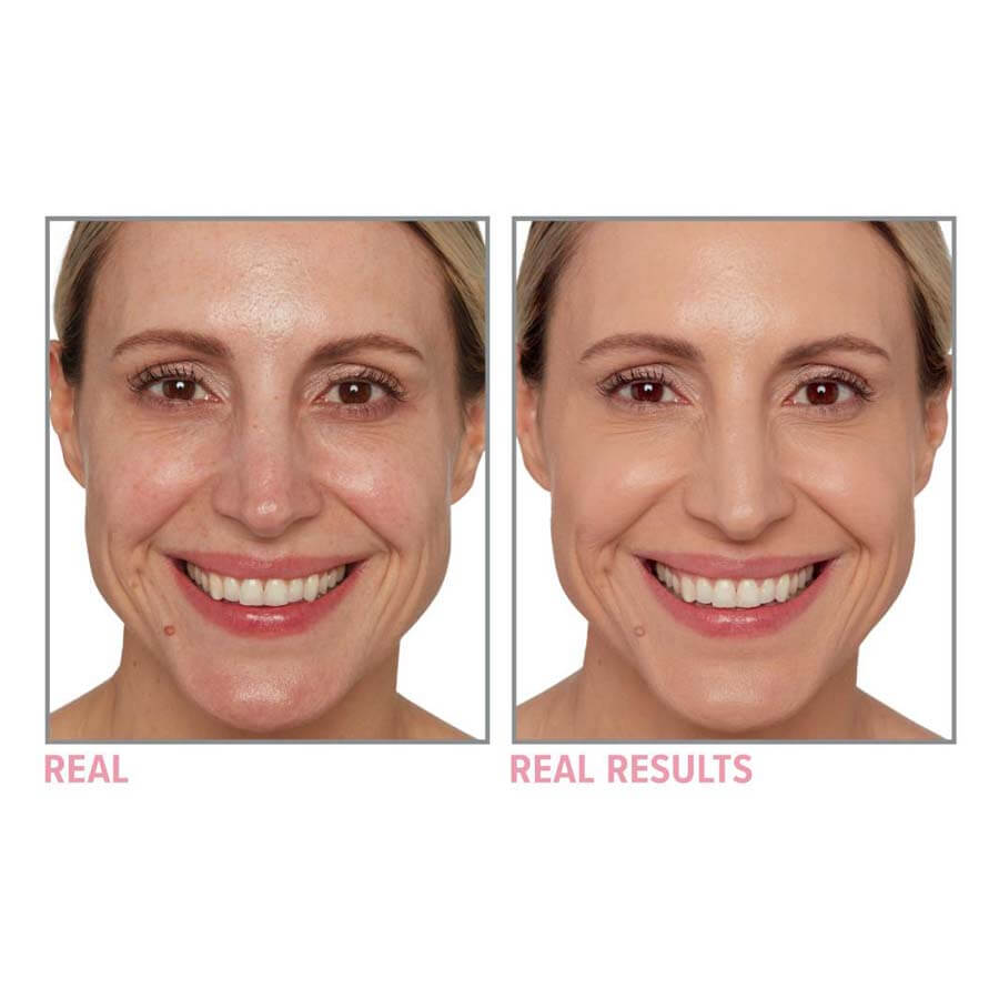 Your Skin But Better Foundation + Skincare