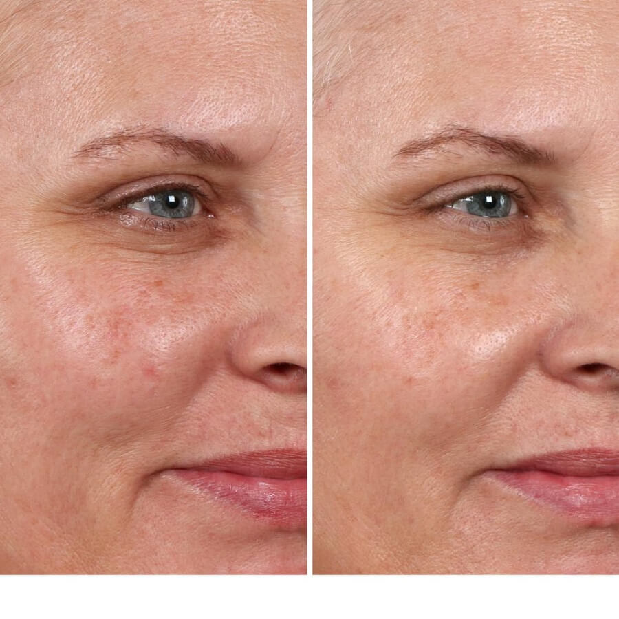 Hello Results Glycolic Peel + Caring Oil