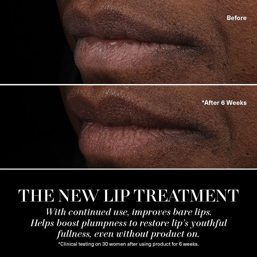 The Lip Treatment