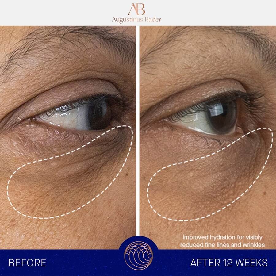 The Eye Cream Set