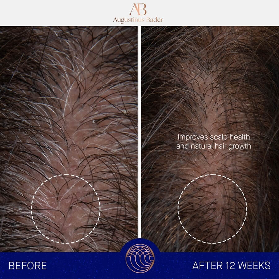 The Scalp Treatment