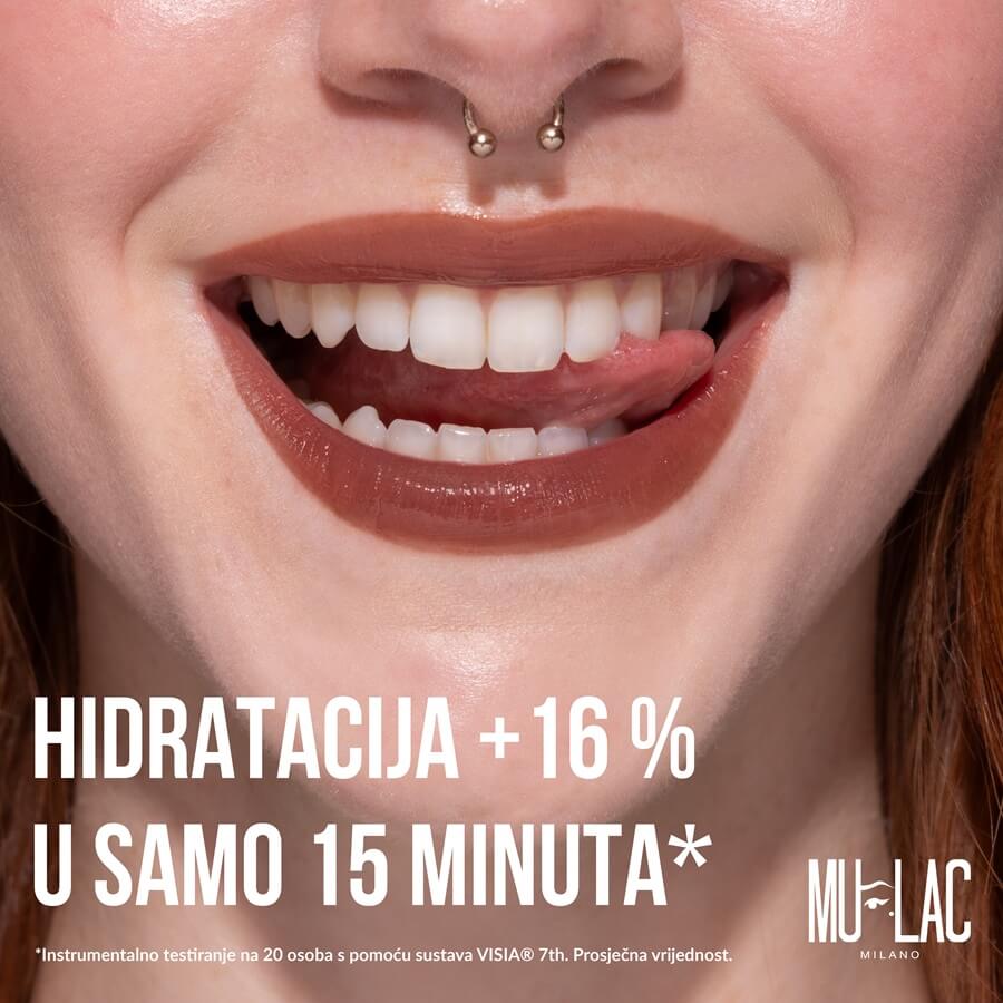 Hydra Stain